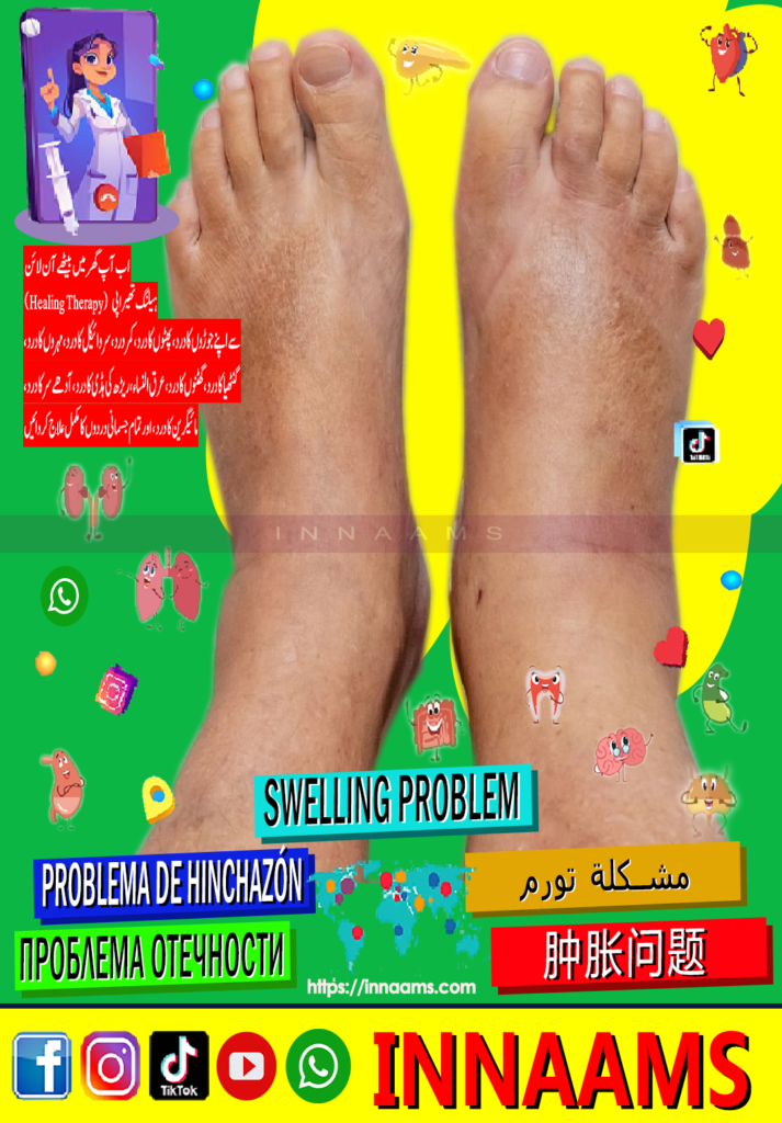 innaams Swalling Problem 002